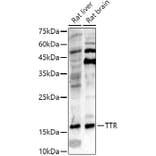 Western Blot - Anti-Prealbumin Antibody (A11408) - Antibodies.com