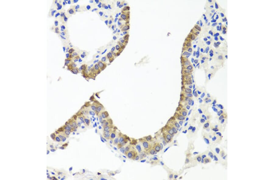Immunohistochemistry - Anti-Prealbumin Antibody (A11408) - Antibodies.com