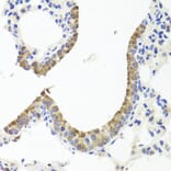 Immunohistochemistry - Anti-Prealbumin Antibody (A11408) - Antibodies.com