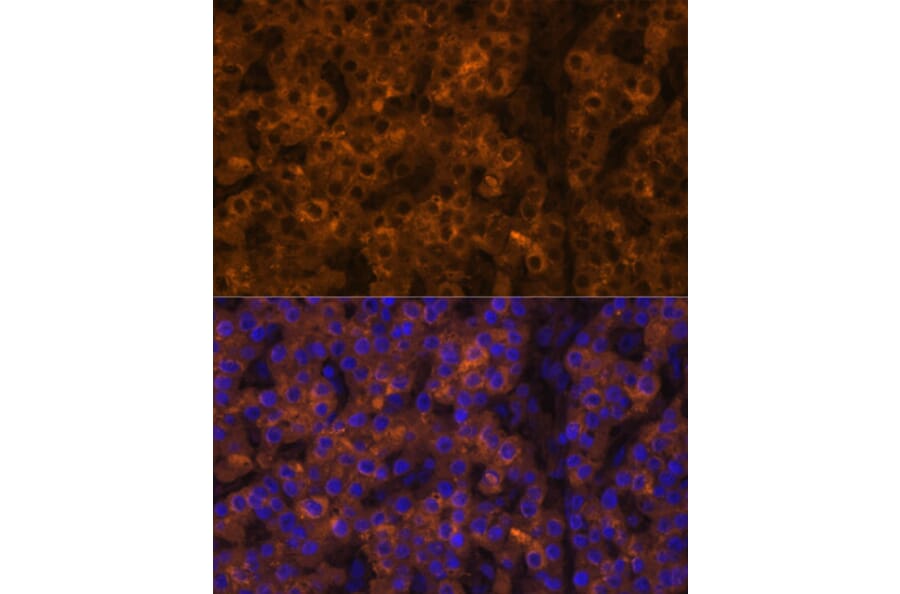 Immunofluorescence - Anti-Prealbumin Antibody (A11408) - Antibodies.com