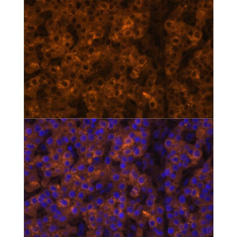 Immunofluorescence - Anti-Prealbumin Antibody (A11408) - Antibodies.com