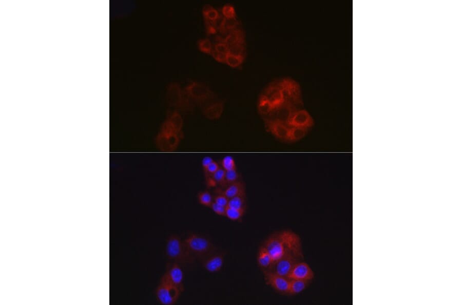 Immunofluorescence - Anti-Apolipoprotein A I Antibody (A11412) - Antibodies.com
