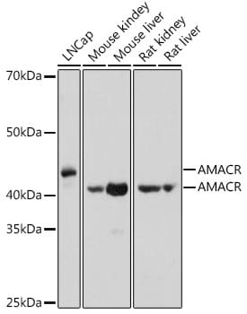 Western blot analysis of extracts of mouse liver, using Anti-AMACR Antibody (A1130) at 1:1,000 dilution.
Secondary antibody: Goat Anti-Rabbit IgG (H+L) (HRP) (AS014) at 1:10,000 dilution.
Lysates / proteins: 25µg per lane.
Blocking buffer: 3% non-fat dry milk in TBST.
Detection: ECL Basic Kit (RM00020).