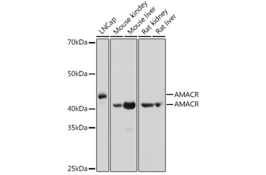 Western Blot - Anti-AMACR Antibody (A11413) - Antibodies.com