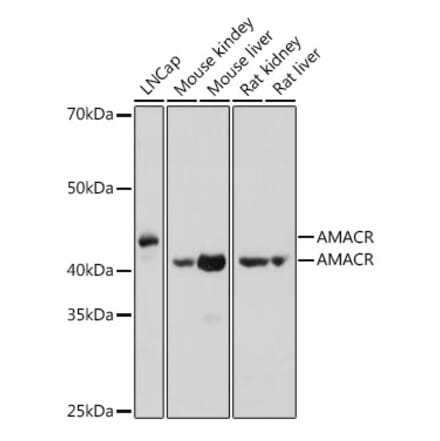 Western Blot - Anti-AMACR Antibody (A11413) - Antibodies.com