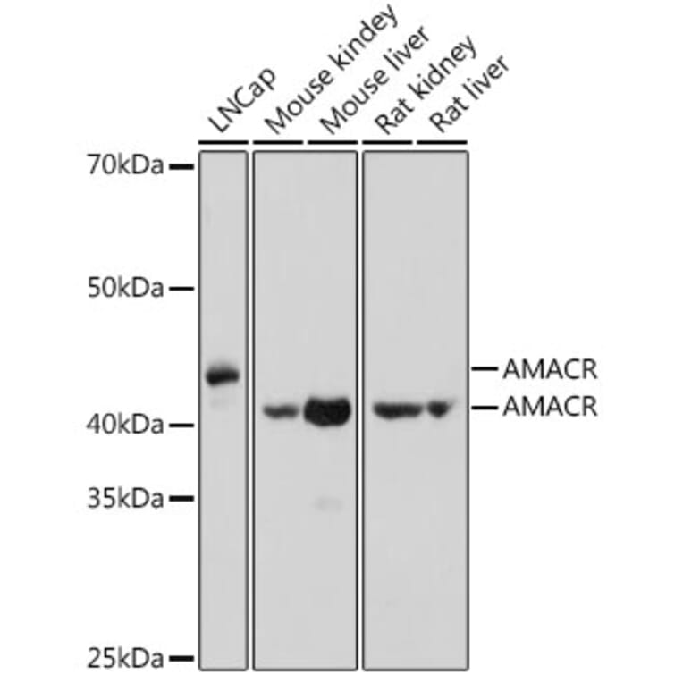 Western Blot - Anti-AMACR Antibody (A11413) - Antibodies.com