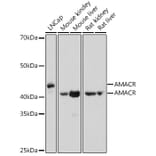 Western Blot - Anti-AMACR Antibody (A11413) - Antibodies.com