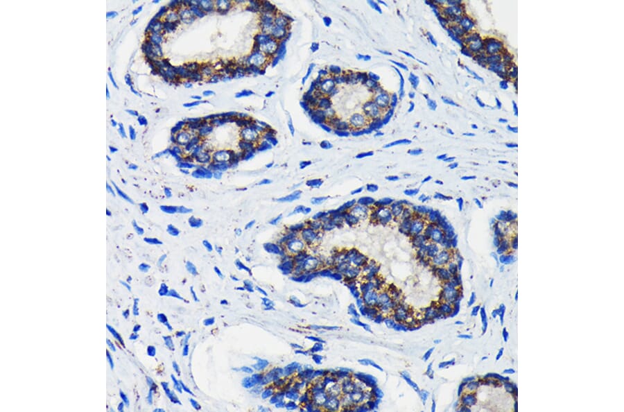 Immunohistochemistry - Anti-AMACR Antibody (A11413) - Antibodies.com