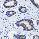 Immunohistochemistry - Anti-AMACR Antibody (A11413) - Antibodies.com