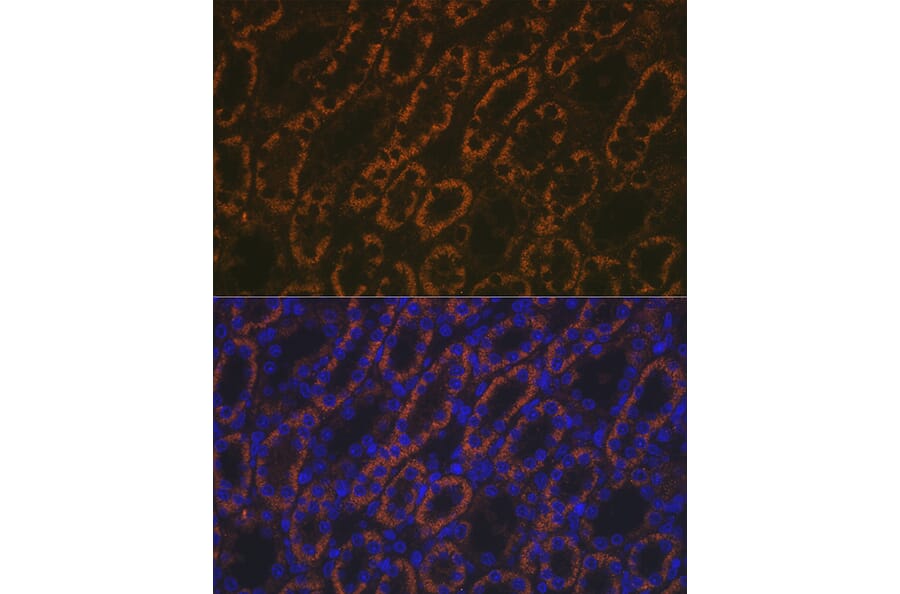 Immunofluorescence - Anti-AMACR Antibody (A11413) - Antibodies.com