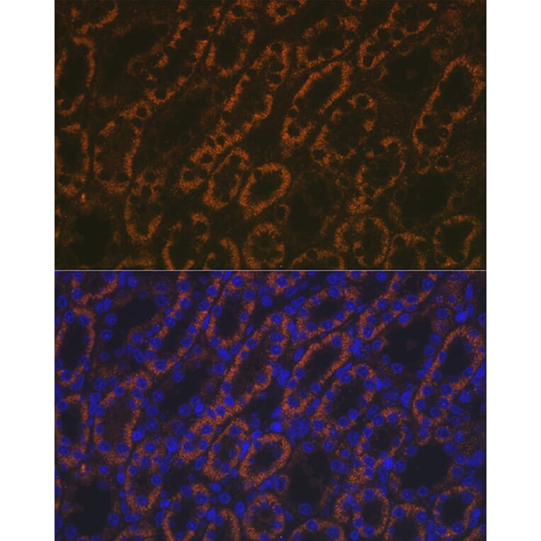 Immunofluorescence - Anti-AMACR Antibody (A11413) - Antibodies.com