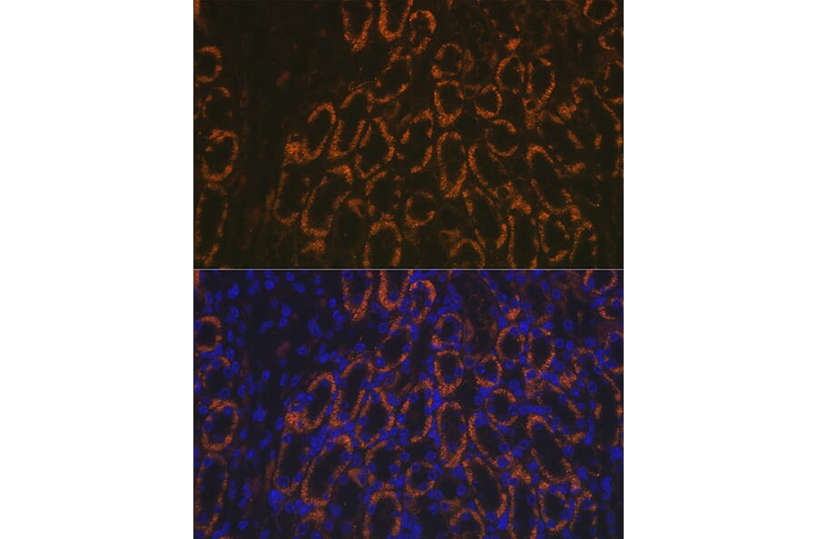 Immunofluorescence - Anti-AMACR Antibody (A11413) - Antibodies.com