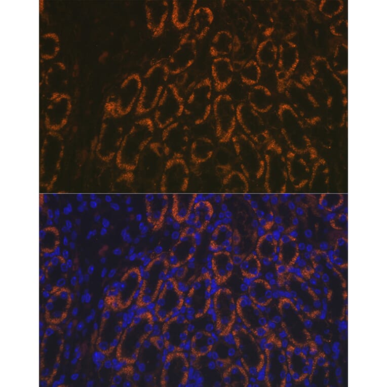 Immunofluorescence - Anti-AMACR Antibody (A11413) - Antibodies.com