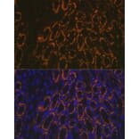 Immunofluorescence - Anti-AMACR Antibody (A11413) - Antibodies.com