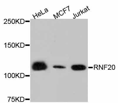Western blot analysis of extracts of various cell lines, using Anti-RNF20 Antibody (A11410).
Secondary antibody: Goat Anti-Rabbit IgG (H+L) (HRP) (AS014) at 1:10,000 dilution.
Lysates / proteins: 25µg per lane.
Blocking buffer: 3% non-fat dry milk in TBST.