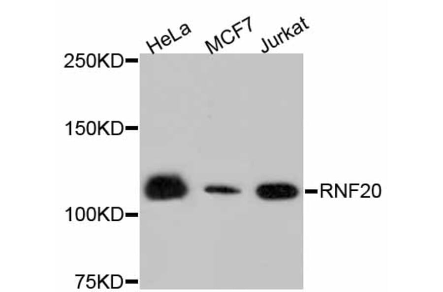 Western Blot - Anti-RNF20 Antibody (A11410) - Antibodies.com