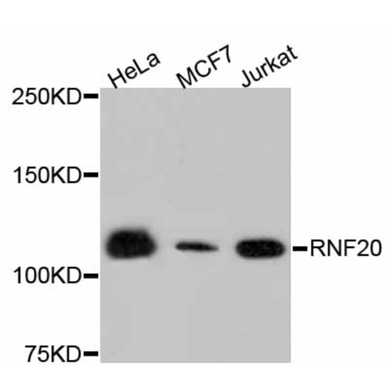 Western Blot - Anti-RNF20 Antibody (A11410) - Antibodies.com