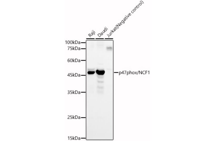 Western Blot - Anti-NCF1/p47-phox Antibody (A11422) - Antibodies.com