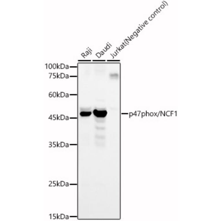Western Blot - Anti-NCF1/p47-phox Antibody (A11422) - Antibodies.com