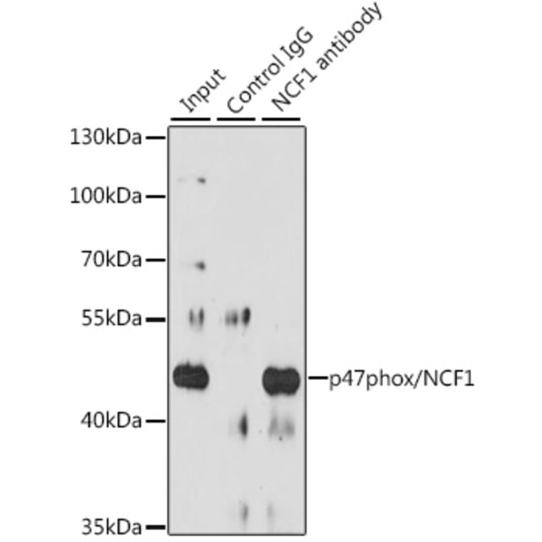 Western Blot - Anti-NCF1/p47-phox Antibody (A11422) - Antibodies.com