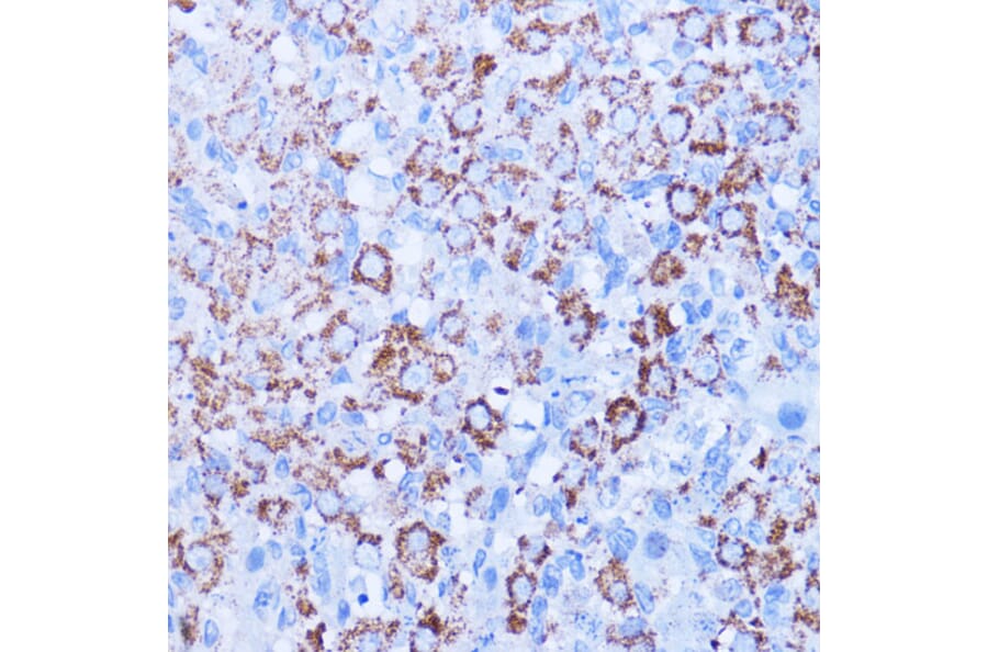 Immunohistochemistry - Anti-ISG15 Antibody (A11423) - Antibodies.com