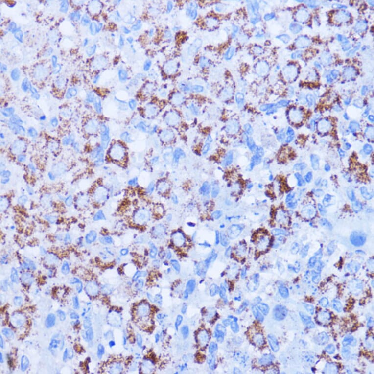 Immunohistochemistry - Anti-ISG15 Antibody (A11423) - Antibodies.com