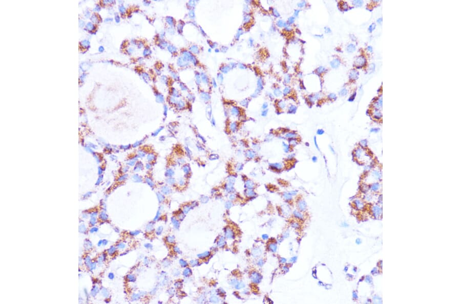Immunohistochemistry - Anti-ISG15 Antibody (A11423) - Antibodies.com