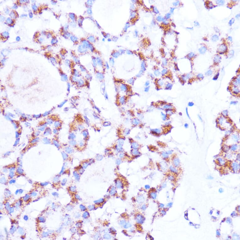 Immunohistochemistry - Anti-ISG15 Antibody (A11423) - Antibodies.com