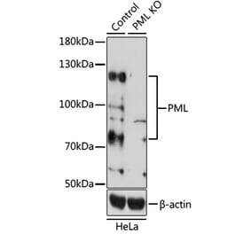 Western Blot - Anti-PML Protein Antibody (A11424) - Antibodies.com