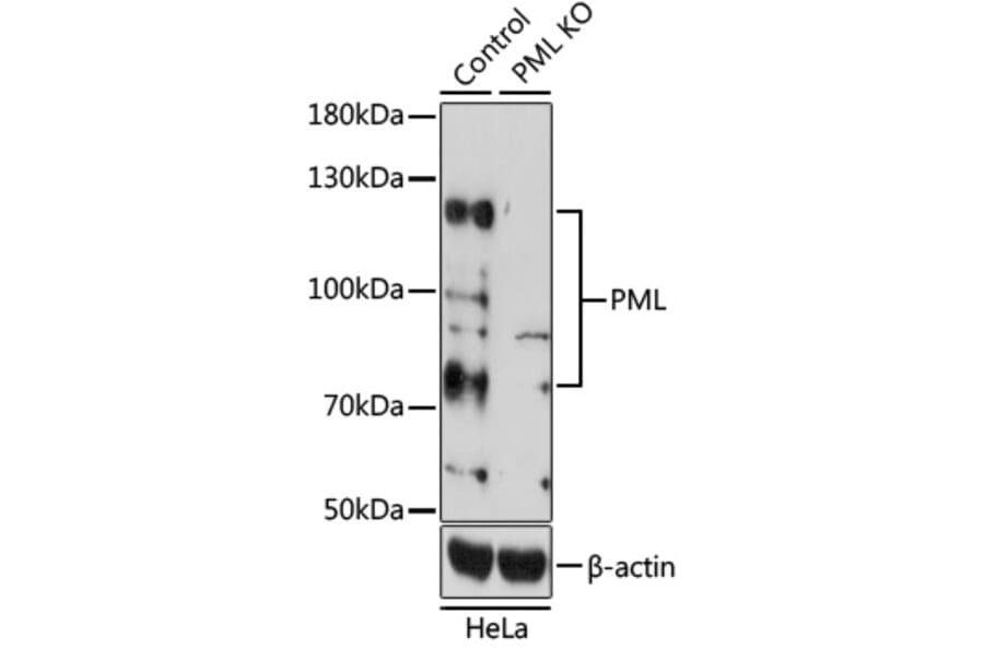 Western Blot - Anti-PML Protein Antibody (A11424) - Antibodies.com