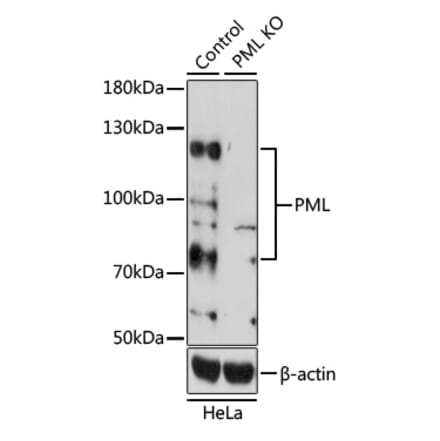 Western Blot - Anti-PML Protein Antibody (A11424) - Antibodies.com