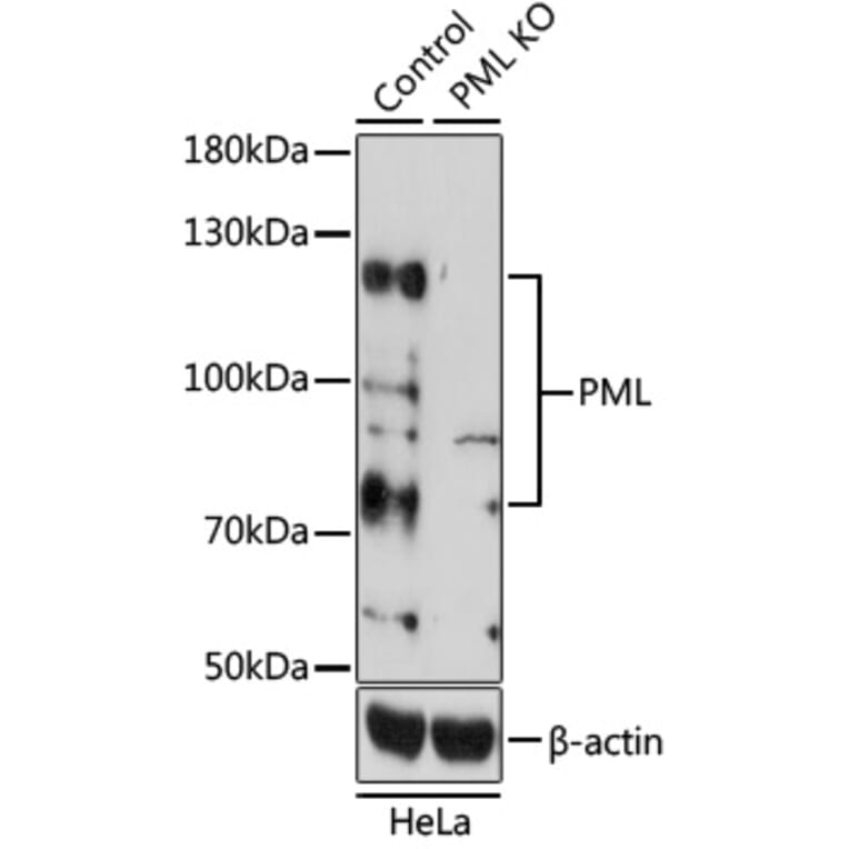 Western Blot - Anti-PML Protein Antibody (A11424) - Antibodies.com
