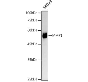 Western Blot - Anti-MMP1 Antibody (A11425) - Antibodies.com