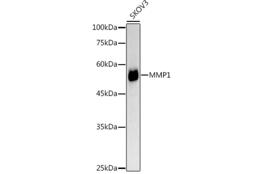 Western Blot - Anti-MMP1 Antibody (A11425) - Antibodies.com