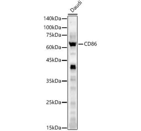 Western Blot - Anti-CD86 Antibody (A11426) - Antibodies.com