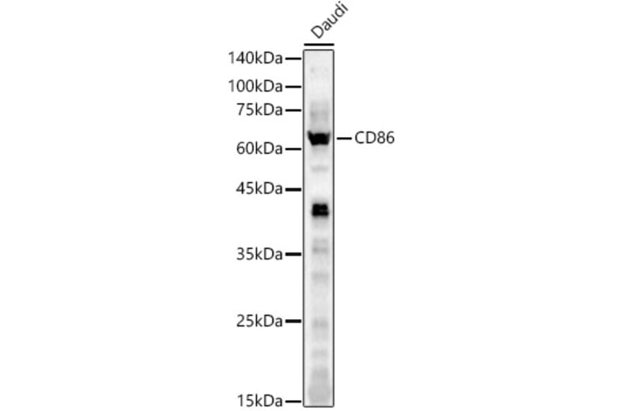 Western Blot - Anti-CD86 Antibody (A11426) - Antibodies.com