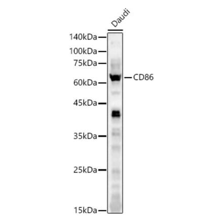 Western Blot - Anti-CD86 Antibody (A11426) - Antibodies.com