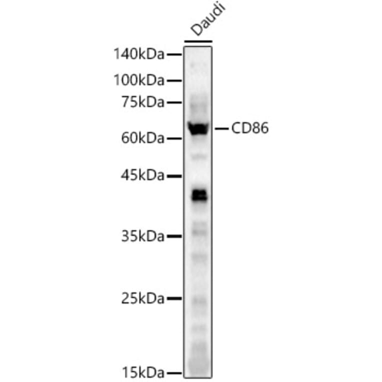 Western Blot - Anti-CD86 Antibody (A11426) - Antibodies.com