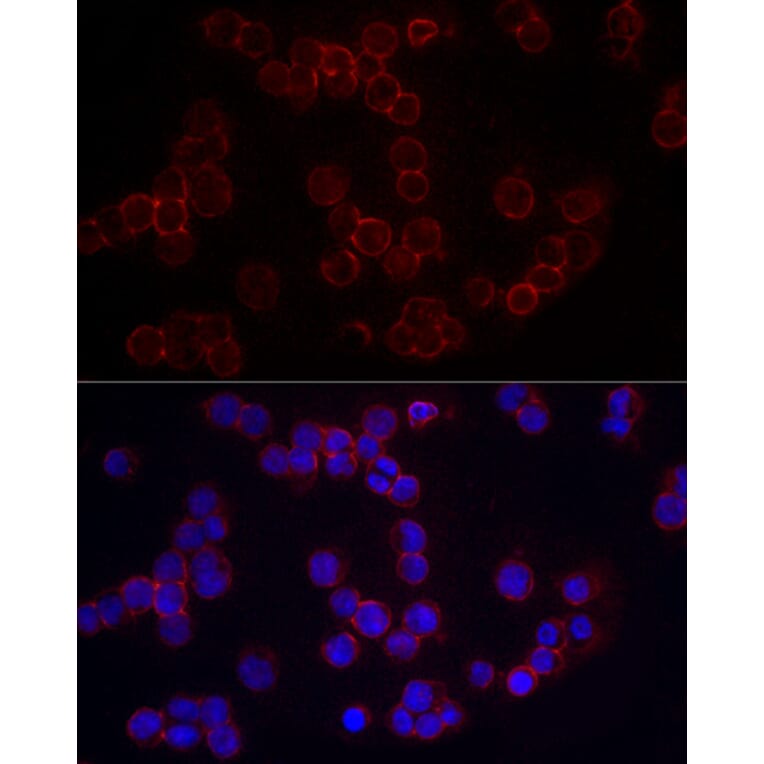 Immunofluorescence - Anti-CD86 Antibody (A11426) - Antibodies.com