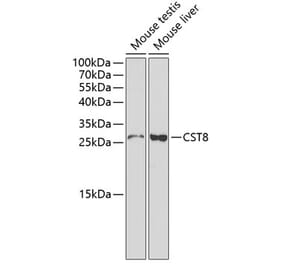 Western Blot - Anti-CST8 Antibody (A1224) - Antibodies.com
