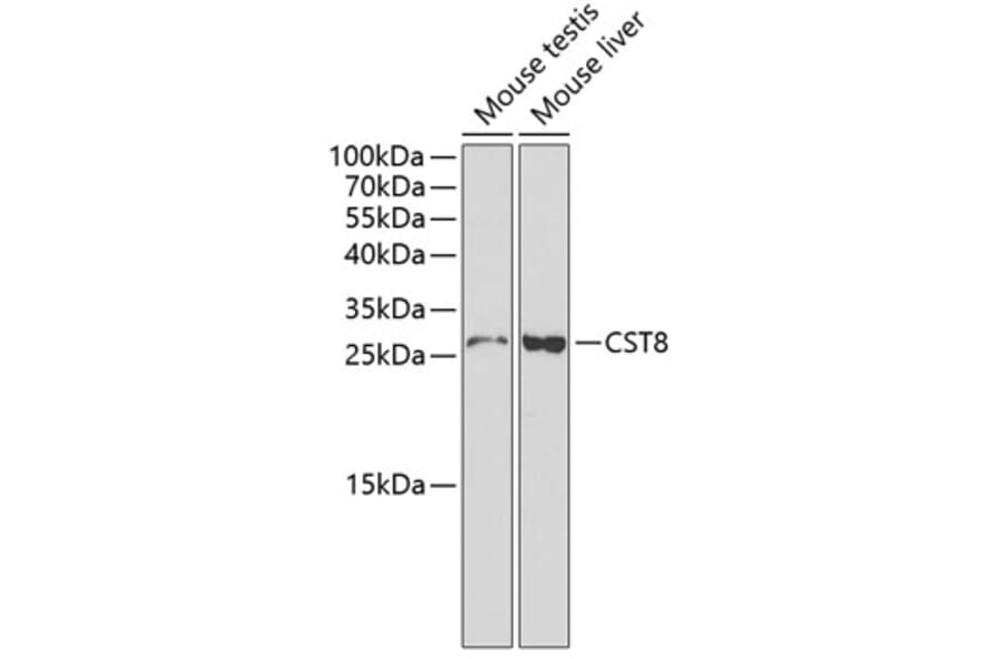 Western Blot - Anti-CST8 Antibody (A1224) - Antibodies.com
