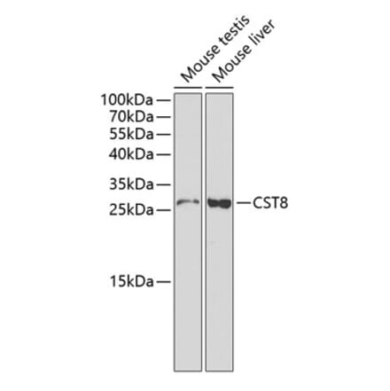 Western Blot - Anti-CST8 Antibody (A1224) - Antibodies.com