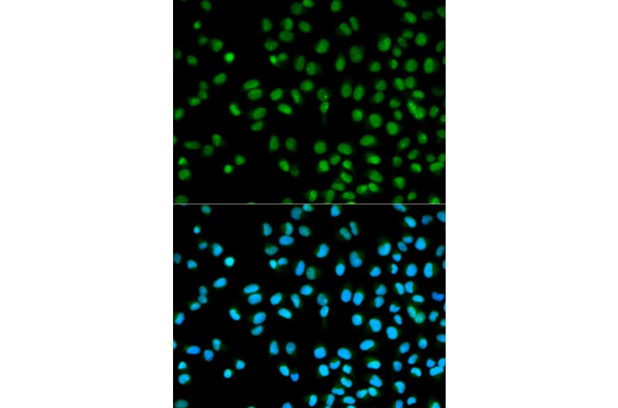 Immunofluorescence - Anti-CST8 Antibody (A1224) - Antibodies.com
