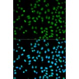 Immunofluorescence - Anti-CST8 Antibody (A1224) - Antibodies.com