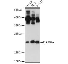 Western Blot - Anti-Secretory phospholipase A2 Antibody (A11428) - Antibodies.com