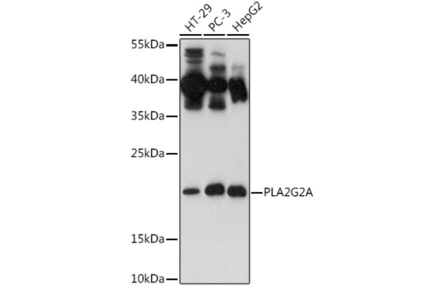 Western Blot - Anti-Secretory phospholipase A2 Antibody (A11428) - Antibodies.com