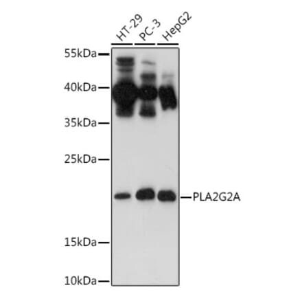 Western Blot - Anti-Secretory phospholipase A2 Antibody (A11428) - Antibodies.com