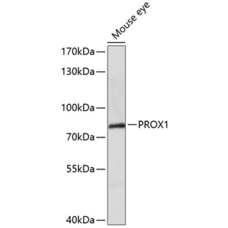 Western Blot - Anti-PROX1 Antibody (A1257) - Antibodies.com