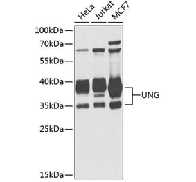 Western Blot - Anti-UNG Antibody (A11430) - Antibodies.com