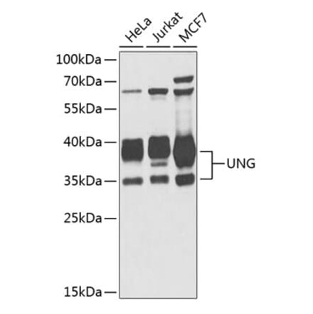 Western Blot - Anti-UNG Antibody (A11430) - Antibodies.com